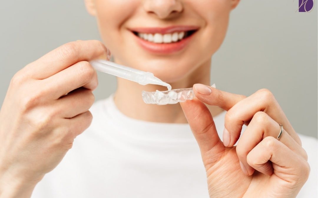 How to Whiten Teeth Quickly: A Guide to Safe Teeth Whitening for the Holidays