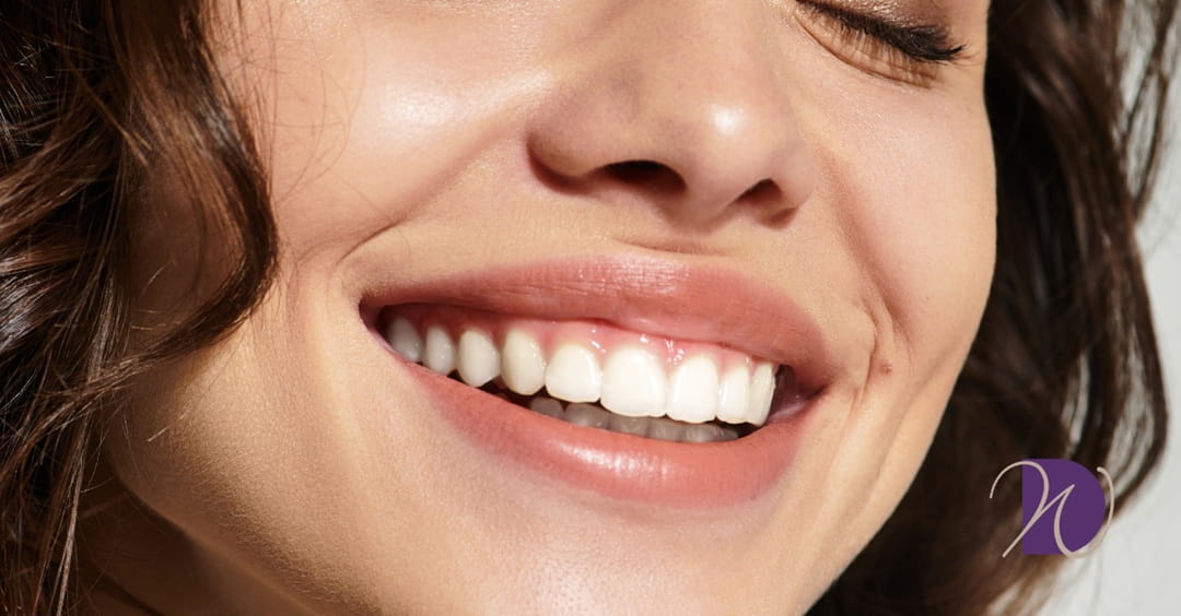 Caring for Your New Smile: How to Make Cosmetic Dental Work Last